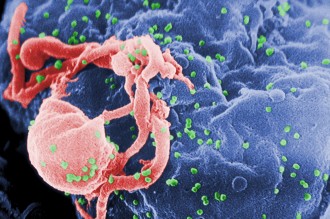 Micrograph of HIV (in Green)